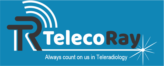 TelecoRay